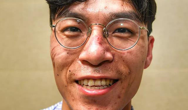這些刻在我們臉上的印痕，會成為永恒的記憶！